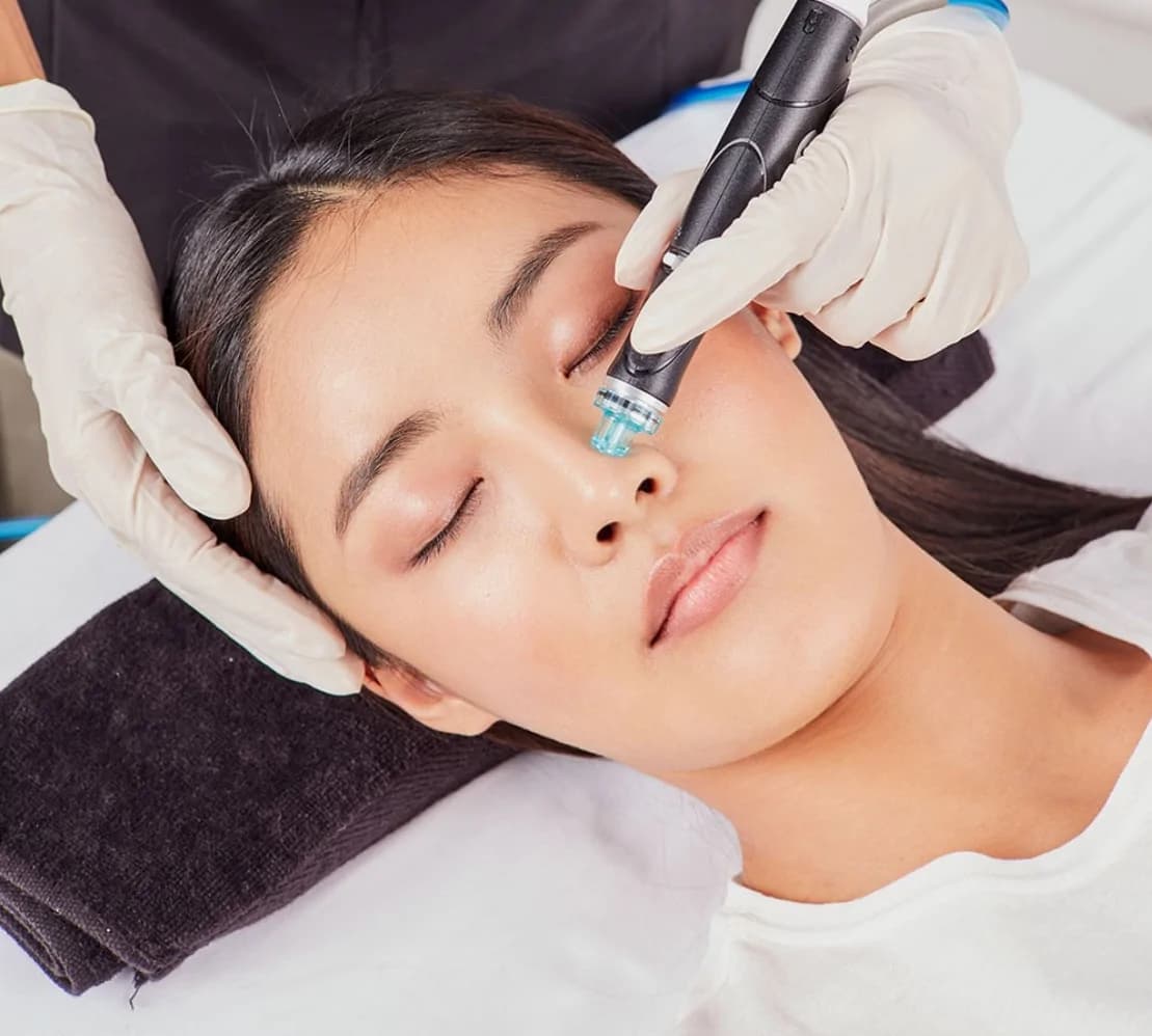 HydraFacial serum treatment at Aries Clinic