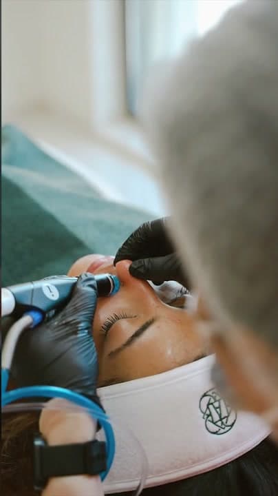 HydraFacial in Dubai video thumbnail